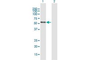 Western Blotting (WB) image for anti-Nuclear Receptor Subfamily 2, Group C, Member 1 (NR2C1) (AA 1-467) antibody (ABIN1774819)