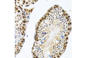 Immunohistochemistry (Paraffin-embedded Sections) (IHC (p)) image for anti-Cold Inducible RNA Binding Protein (CIRBP) (AA 1-172) antibody (ABIN6138628)