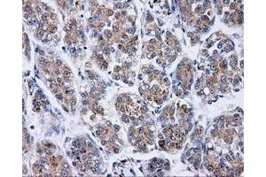 Immunohistochemistry (IHC) image for anti-Bruton Agammaglobulinemia tyrosine Kinase (BTK) antibody (ABIN1496972) (BTK Antikörper)