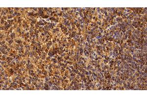 Detection of CD8a in Human Spleen Tissue using Polyclonal Antibody to Cluster Of Differentiation 8a (CD8a)