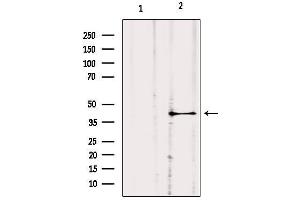 Western Blotting (WB) image for anti-Guanine Nucleotide Binding Protein (G Protein), alpha 11 (Gq Class) (GNA11) (Internal Region) antibody (ABIN6262007)