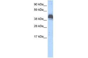 Human Thymus; WB Suggested Anti-ZNF297B Antibody Titration: 0. (ZBTB43 Antikörper  (Middle Region))