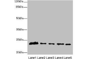 Western blot All lanes: MMD2 antibody at 3 μg/mL Lane 1: Mouse brain tissue Lane 2: Mouse kidney tissue Lane 3: U251 whole cell lysate Lane 4: 293T whole cell lysate Lane 5: Mouse liver tissue Secondary Goat polyclonal to rabbit IgG at 1/10000 dilution Predicted band size: 32, 29, 23 kDa Observed band size: 23 kDa (MMD2 Antikörper  (AA 1-38))
