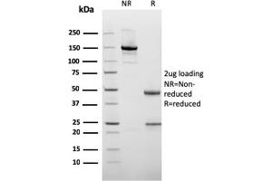 SDS-PAGE Analysis of Purified Cytokeratin 10 Mouse Recombinant Monoclonal Antibody (rKRT10/1275). (Rekombinanter Keratin 10 Antikörper)