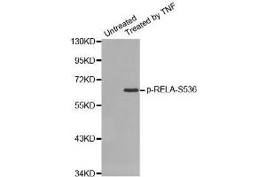 Western blot analysis of extracts from HepG2 cells using Phospho-RELA-S536 antibody (ABIN2987368). (NF-kB p65 Antikörper  (pSer536))