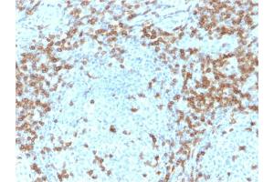 Immunohistochemistry (IHC) image for anti-CD5 (CD5) (AA 269-366) antibody (ABIN6941057)