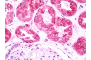 Immunohistochemistry (IHC) image for anti-Low Density Lipoprotein Receptor-Related Protein Associated Protein 1 (LRPAP1) (AA 31-325) antibody (ABIN1960179)