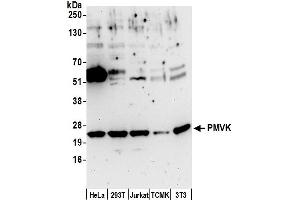 anti-Phosphomevalonate Kinase (PMVK) (AA 142-192) antibody