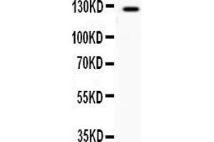 Western blot analysis of AFF44 expression in COLO320 whole cell lysates ( Lane 1).