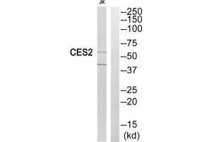 Western Blotting (WB) image for anti-Carboxylesterase 2 (CES2) (Internal Region) antibody (ABIN1851018) (CES2 Antikörper  (Internal Region))