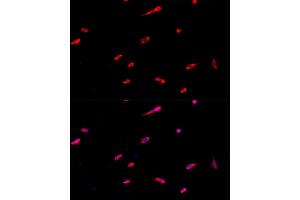 Immunofluorescence analysis of PC-12 cells using EIF3J antibody (ABIN6127835, ABIN6140070, ABIN6140071 and ABIN6224734) at dilution of 1:100. (EIF3S1 Antikörper  (AA 1-258))