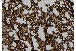 ABIN6272400 at 1/100 staining Mouse lung tissue by IHC-P. (POTE-14/22 Antikörper)