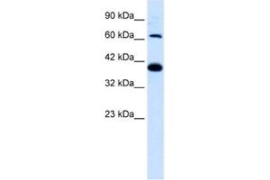 Western Blotting (WB) image for anti-Glutamate Receptor, Ionotropic, Kainate 2 (GRIK2) antibody (ABIN2461162) (GRIK2 Antikörper)