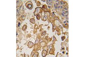 Image no. 1 for anti-Toll-Like Receptor 6 (TLR6) (C-Term) antibody (ABIN357055) (TLR6 Antikörper  (C-Term))