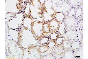 Immunohistochemistry (IHC) image for anti-Tumor Necrosis Factor Receptor Superfamily, Member 8 (TNFRSF8) (AA 131-230) antibody (ABIN741090)