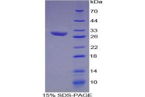 SDS-PAGE analysis of Rat Hydroxyacid Oxidase 1 Protein. (HAO1 Protein)