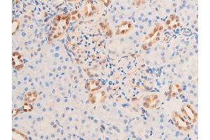 ABIN6267073 at 1/100 staining rat kidney tissue sections by IHC-P. (CHEK1 Antikörper  (pSer280))