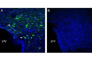 Expression of /LRRC4 in rat hypothalamus. (LRRC4 Antikörper  (Extracellular))
