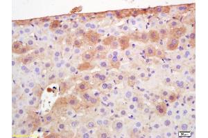 Formalin-fixed and paraffin embedded mouse liver labeled with Rabbit Anti Adiponectin Polyclonal Antibody, Unconjugated (ABIN669051) at 1:200 followed by conjugation to the secondary antibody and DAB staining (ADIPOQ Antikörper  (AA 151-244))