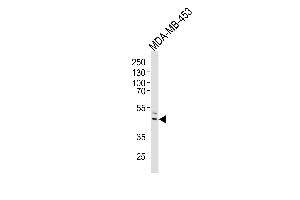 Western blot analysis of lysate from MDA-MB-453 cell line, using IL5RA Antibody at 1:1000 at each lane.