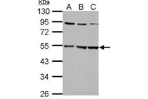 WB Image Sample (30 ug of whole cell lysate) A: 293T B: A431 C: HepG2 10% SDS PAGE antibody diluted at 1:5000 (GLRa2 Antikörper)