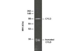 Detection of CYLD in HeLa S100 cytosolic fraction (, 10 μg) by Western blotting using PAb to CYLD (human)  at 1:5000 dilution.