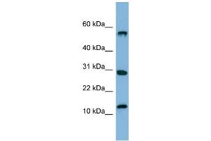 WB Suggested Anti-SRAntibody Titration:  0. (SRP19 Antikörper  (Middle Region))
