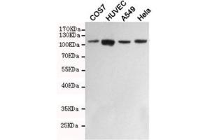 Western Blotting (WB) image for anti-PTK2 Protein tyrosine Kinase 2 (PTK2) antibody (ABIN4953249)