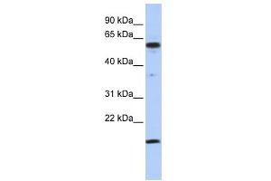WB Suggested Anti-TRIAntibody Titration:  0. (TRIP10 Antikörper  (Middle Region))