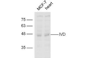line1,MCF-7 lysates；line2,mouse heart lysate probed with Rabbit Anti-IVD Polyclonal Antibody, Unconjugated  at 1:5000 for 90min at 37˚C. (IVD Antikörper  (AA 201-300))