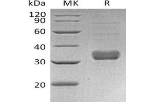 Western Blotting (WB) image for Collectin Sub-Family Member 11 (COLEC11) protein (His tag) (ABIN7320843)