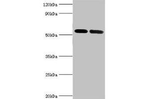 Western blot All lanes: V-type proton ATPase subunit B, kidney isoform antibody at 7 μg/mL Lane 1: Mouse kidney tissue Lane 2: 293T whole cell lysate Secondary Goat polyclonal to rabbit IgG at 1/10000 dilution Predicted band size: 57 kDa Observed band size: 57 kDa (ATP6V1B1 Antikörper  (AA 1-280))