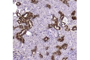 IHC testing of FFPE rat kidney tissue with CKB antibody at 1ug/ml. (CKB Antikörper)