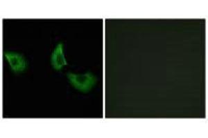 Immunofluorescence analysis of A549 cells, using EFEMP2 antibody. (FBLN4 Antikörper)