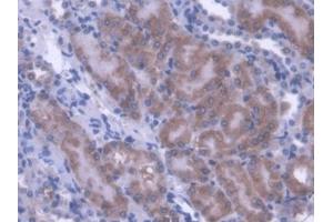 IHC-P analysis of Mouse Kidney Tissue, with DAB staining. (ACADS Antikörper  (AA 210-397))