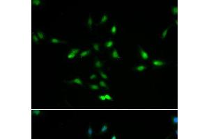 Immunofluorescence analysis of A549 cells using MDM2 Polyclonal Antibody (MDM2 Antikörper)
