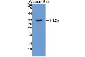 Western blot analysis of the recombinant protein. (Paxillin Antikörper  (AA 327-568))