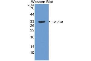 Western blot analysis of the recombinant protein. (Paxillin Antikörper  (AA 327-568))
