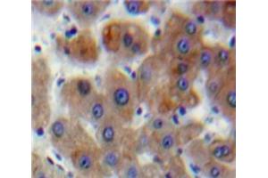 IHC-P analysis of Liver tissue, with DAB staining. (DVL1 Antikörper  (AA 150-332))