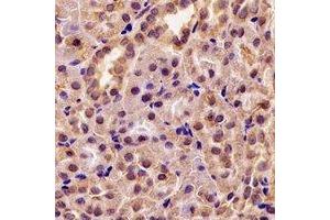 Immunohistochemical analysis of GRP75 staining in rat kidney formalin fixed paraffin embedded tissue section. (HSPA9 Antikörper)