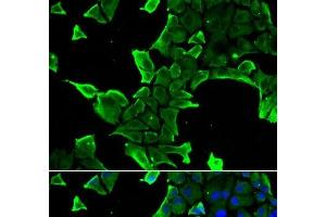 Immunofluorescence analysis of A549 cells using NCS1 Polyclonal Antibody (NCS1 Antikörper)