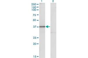Western Blot analysis of DLX3 expression in transfected 293T cell line by DLX3 monoclonal antibody (M09), clone 3F7. (DLX3 Antikörper  (AA 1-287))