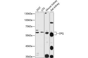 Western blot analysis of extracts of various cell lines, using CPQ antibody  at 1:1000 dilution. (CPQ Antikörper  (AA 1-100))
