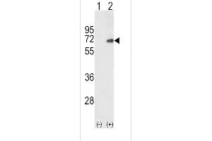 Western blot analysis of SD4 (arrow) using rabbit polyclonal SD4 Antibody (C-term) (ABIN652388 and ABIN2841883). (SMAD4 Antikörper  (C-Term))