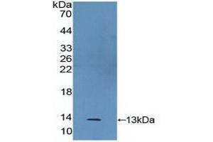 Detection of Recombinant S100A2, Human using Polyclonal Antibody to S100 Calcium Binding Protein A2 (S100A2) (S100A2 Antikörper  (AA 2-98))