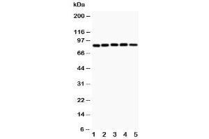 Western blot testing of IKK alpha antibody and Lane 1:  MCF-7 (IKK alpha Antikörper  (AA 411-745))