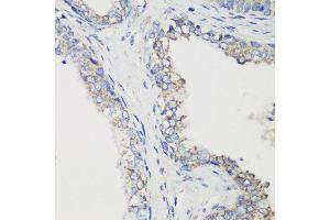 Immunohistochemistry of paraffin-embedded human prostate using GLUD1 antibody at dilution of 1:200 (40x lens). (GLUD1 Antikörper)