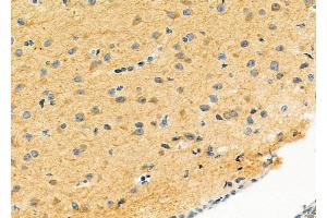 ABIN6263007 and ABIN6279522 at 1/100 staining Mouse brain tissue by IHC-P. (LRP4 Antikörper  (N-Term))