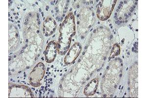 Image no. 1 for anti-Cancer/testis Antigen 1B (CTAG1B) antibody (ABIN1499893) (CTAG1B Antikörper)