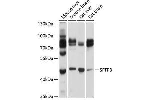 Western blot analysis of extracts of various cell lines, using SFTPB Antibody (ABIN6147687) at 1:1000 dilution. (SFTPB Antikörper  (AA 94-393))